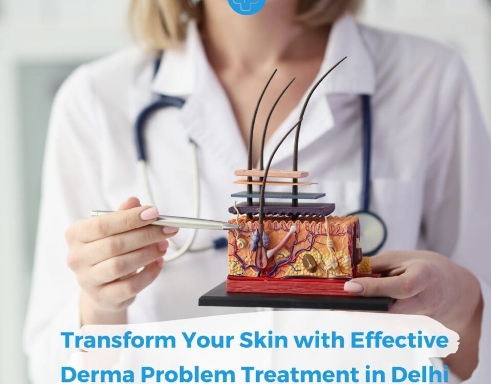 Transform Your Skin with Effective Derma Problem Treatment in Delhi